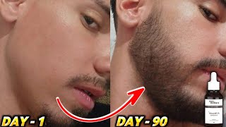 Beard growth  तीन महीने में दाढ़ी उगाए  man matters beard oil reviewman matters minoxidil review [upl. by Robina]