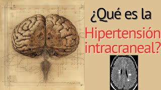 Hipertensión Intracraneal Perlas [upl. by Habeh648]