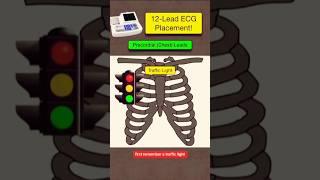 12 Lead ECG placement ECG leads kaise lagay ecg biology shorts youtubeshorts youtube [upl. by Alyad140]