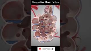 Congestive Heart Failure Explain 3DAnimation shorts [upl. by Nairadal]