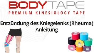 Kinesiology Tape Anleitung Entzündung des Kniegelenks Rheuma [upl. by Neenaej725]