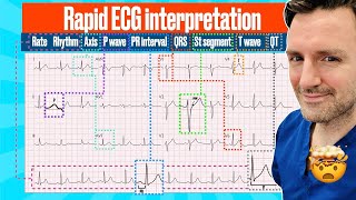 Rapid structured ECG interpretation A visual guide FOR REVISION electrocardiogram [upl. by Schroder]