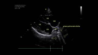 veterinary heartworm cardiologie echocardiography vétérinaire Dirofilaria [upl. by Sinnelg304]