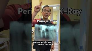 How to Take PERFECT Dental XRays Periapical  In Office to Hands On Dental Training shorts [upl. by Wilek515]