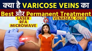 Venaseal Glue or Laser Treatment For Varicose Veins Comparison by Vein Specialist [upl. by Jarietta730]