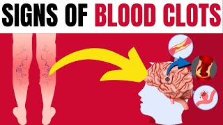 TOP 9 WARNING SIGNS OF BLOOD CLOTS You Should Never Ignore [upl. by Liakim356]