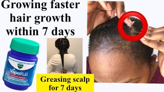 GREASING SCALP Everyday WITH VICKS VAPOUR RUB 7 DAY CHALLENGE Vicks vapour rub for hair growth [upl. by Schoenburg226]