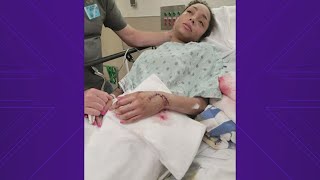 Oklahoma woman says she punched shark that attacked her during trip to Galveston [upl. by Woodrow]