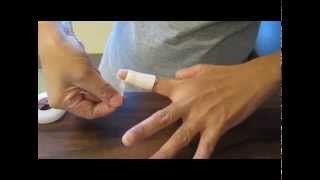 How to Clean your finger when you have a Mallet Finger Injury Splint A [upl. by Howell402]