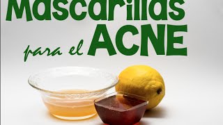 Cómo eliminar las manchas y aclarar la piel en 7 días Super mascarilla [upl. by Aneerahs]