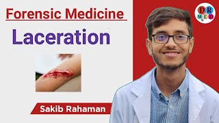 Laceration  Lacerated incised looking wound  Forensic medicine amp toxicology bangla lecture [upl. by Rohn]