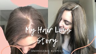 My Hair Loss Story  Androgenic Alopecia [upl. by Aeuhsoj]