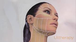 Ultherapy  how it works [upl. by Kuehnel]