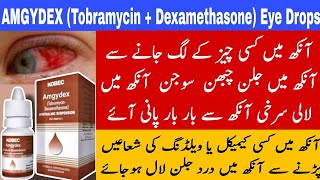 Amgydex drops uses in Urdu  eye infection treatment Conguntivitis infectionTobramycin [upl. by Ynabla]