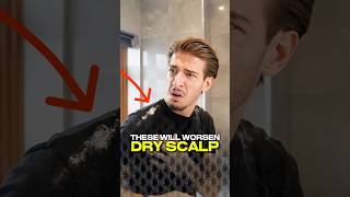 How To PREVENT Dry Scalp 💆‍♂️✅ [upl. by Etz]