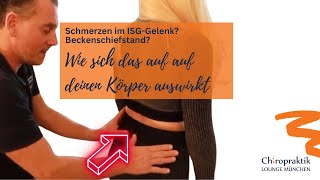 ISG Blockierung und Beckenschiefstand  wie sich das auf deinen Körper auswirkt [upl. by Anerak]