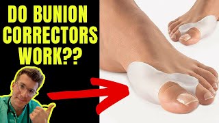 DO BUNION CORRECTORS WORK Doctor explains [upl. by Nino]