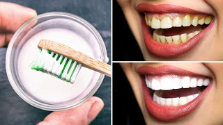 Hydrogen Peroxide Teeth Whitening  How To Get The Best Results [upl. by Seana]