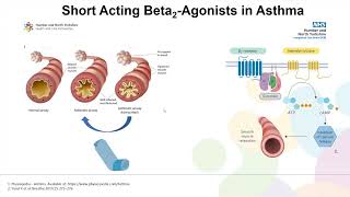 Transforming Asthma Care [upl. by Pillihp]