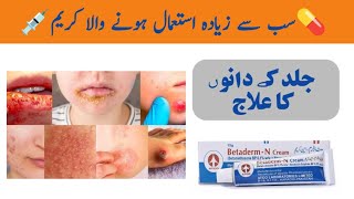 Betaderm N Cream uses in Urdu  Acne Cream Review [upl. by Htes695]