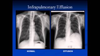 Review of Chest Image Interpretation [upl. by Ahsienel]