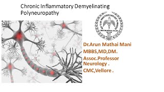 Chronic Inflammatory Demyelinating Polyneuropathy CIDP  DrArun Mathai CMC Vellore [upl. by Elledoj88]