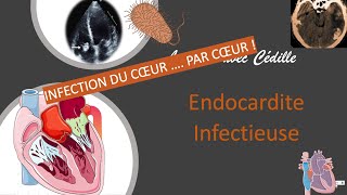 Urgences  la lecon avec cedille  endocardite infectieuse infection du coeur ♥️ [upl. by Shwalb730]