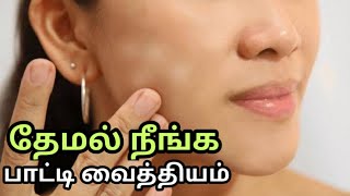 தேமல் சரியாக பாட்டி வைத்தியம்Themal maraiya tips tamilThemal poga tips in tamilதேமல் மறையRemedy [upl. by Hagi]