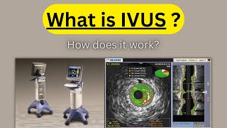 What is IVUS Intra Vascular Ultrasound amp How does it work [upl. by Wenn]