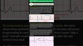 ECG EKG 2 Premature Atrial Contractions PACs [upl. by Aioj]