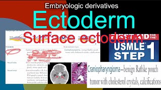 Embryologic derivatives  Ectoderm Surface ectoderm Craniopharyngioma in HindiUrdu by first aid [upl. by Onaivlis625]