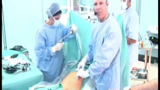 How i do a laparoscopic approach in case of scar abdomen [upl. by Eylk]