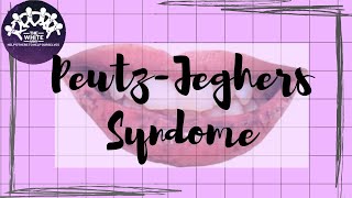 Quick Discussion Series  PeutzJeghers Syndrome [upl. by Hagood]