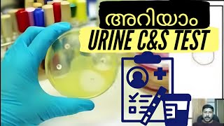 Urine Culture amp Sensitivity Test Malayalam [upl. by Eralcyram162]