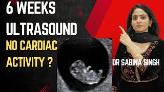 Why Heart Beat Never Comes In Early Pregnancy  6 weeks of pregnancy and ultrasound [upl. by Eisenhart]