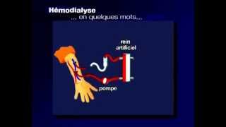 comment ça marche lhémodialyse [upl. by Dorolice]