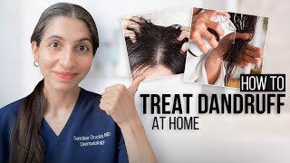 Dermatologist Explains How to Treat Dandruff at Home I Dr Sanober Pezad Doctor [upl. by Atinihc]