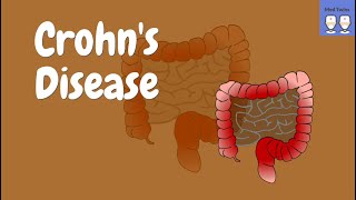 Crohns disease Pathophysiology Gross amp Microscopic morphology Signs amp Symptoms [upl. by Asus]