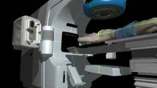 Varian IGRT kVMV Imaging [upl. by Kciremed220]