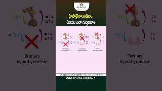 Hypothyroidism Causes and Symptoms  hypothyroidism shorts ytshorts thyroid [upl. by Hart18]