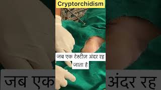 Cryptorchidism l Dr Umar Khan [upl. by Jecon]