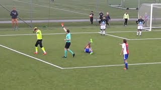 GRAPHIC Soccer Goalie BREAKS Opponents Leg in Tackle [upl. by Ward]