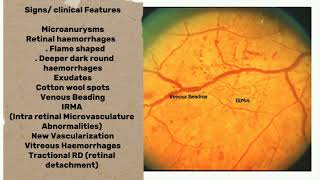 Diabetic Retinopathy risk factors signs classification and Treatment Options opthalmology [upl. by Flavio]