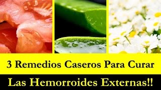 3 Remedios Caseros Para Curar Las Hemorroides Externas [upl. by Nytsyrk152]