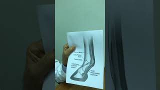 مفصل المعقم في الخيل affection of fetlock joint in horse [upl. by Quigley]