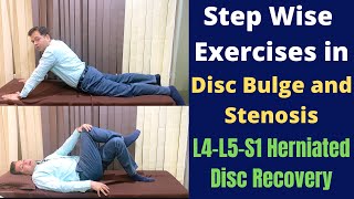 Exercises For Herniated Disc Disc Bulge L4L5S1 Step Wise Treatment for Slipped Disc Recovery [upl. by Pineda]