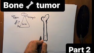 Bone tumor Pathalogy HINDI 🍖 GIANT CELL TUMORbenign and malignant part2 [upl. by Atikir302]