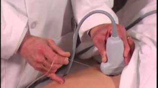 How To Ultrasound Guided Hip Injection Scanning Technique Video [upl. by Hyo755]