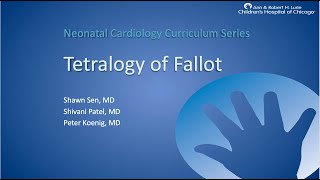 Tetralogy of Fallot [upl. by Jareen]