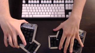 ErgoDox Opensource Split Fully Programmable Ergonomic Mechanical Keyboard Review [upl. by Burnett]